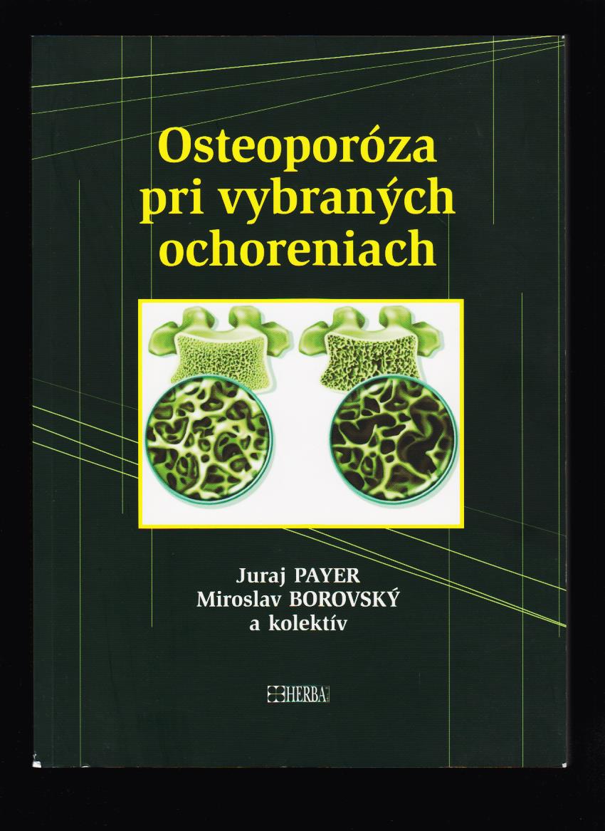 Juraj Payer, Miroslav Borovský: Osteoporóza pri vybraných ochoreniach